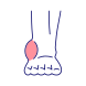 Inflammation, or swelling